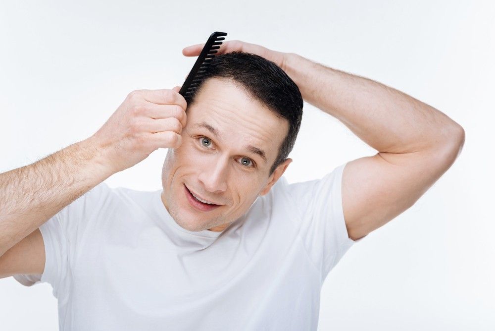 Alopecia-Areata
