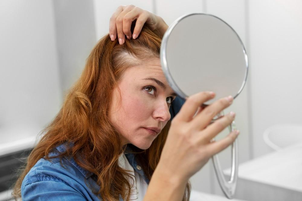 Female-Pattern-Baldness