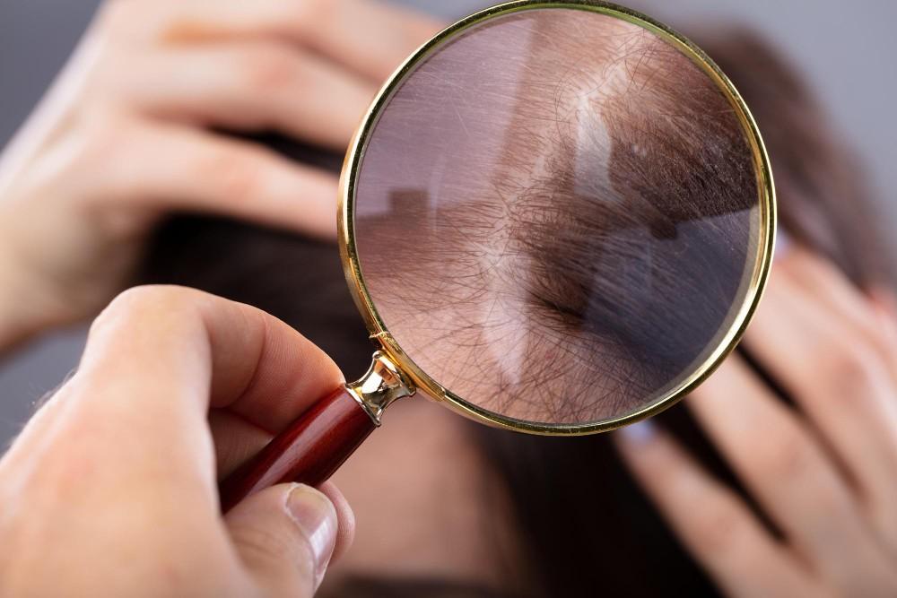 Trichotillomania